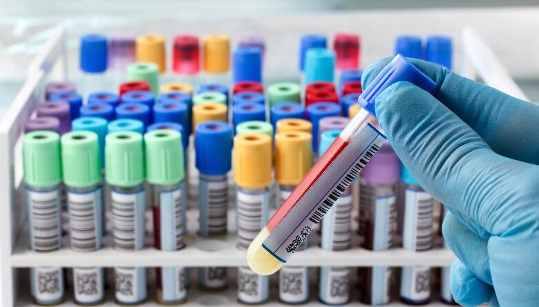 Monocitos Altos en Sangre: Comprende Síntomas, Causas y Opciones de Tratamiento Efectivas