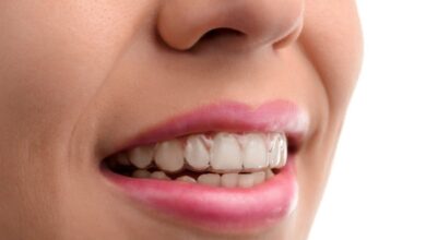 Todo lo que necesitas saber sobre la ortodoncia invisible Invisalign: beneficios, tratamiento y cuidados Todo lo que necesitas saber sobre la ortodoncia invisible Invisalign: beneficios, tratamiento y cuidados