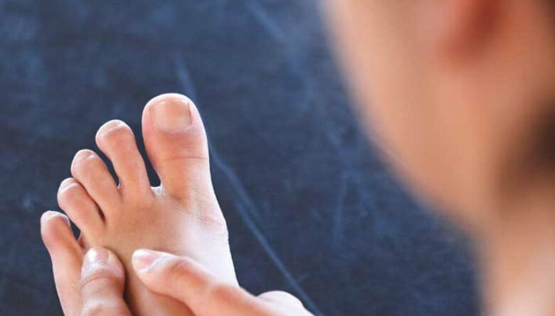 Guía Completa sobre Ampollas: Causas, Tratamiento y Consejos para el Cuidado de la Piel