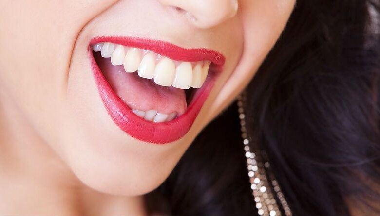 Ventajas de los implantes dentales: Todo lo que necesitas saber para una sonrisa perfecta